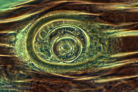 Larva trichinely