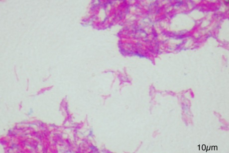 Mycobacterium bovis