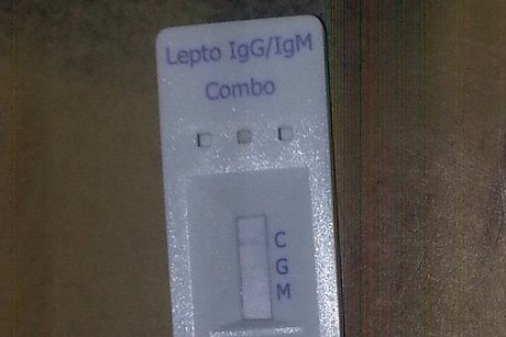 Leptospiróza
